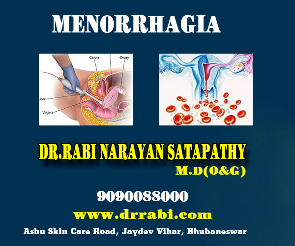 best menorrhagia treatment clinic in bhubaneswar close to aditya care hospital